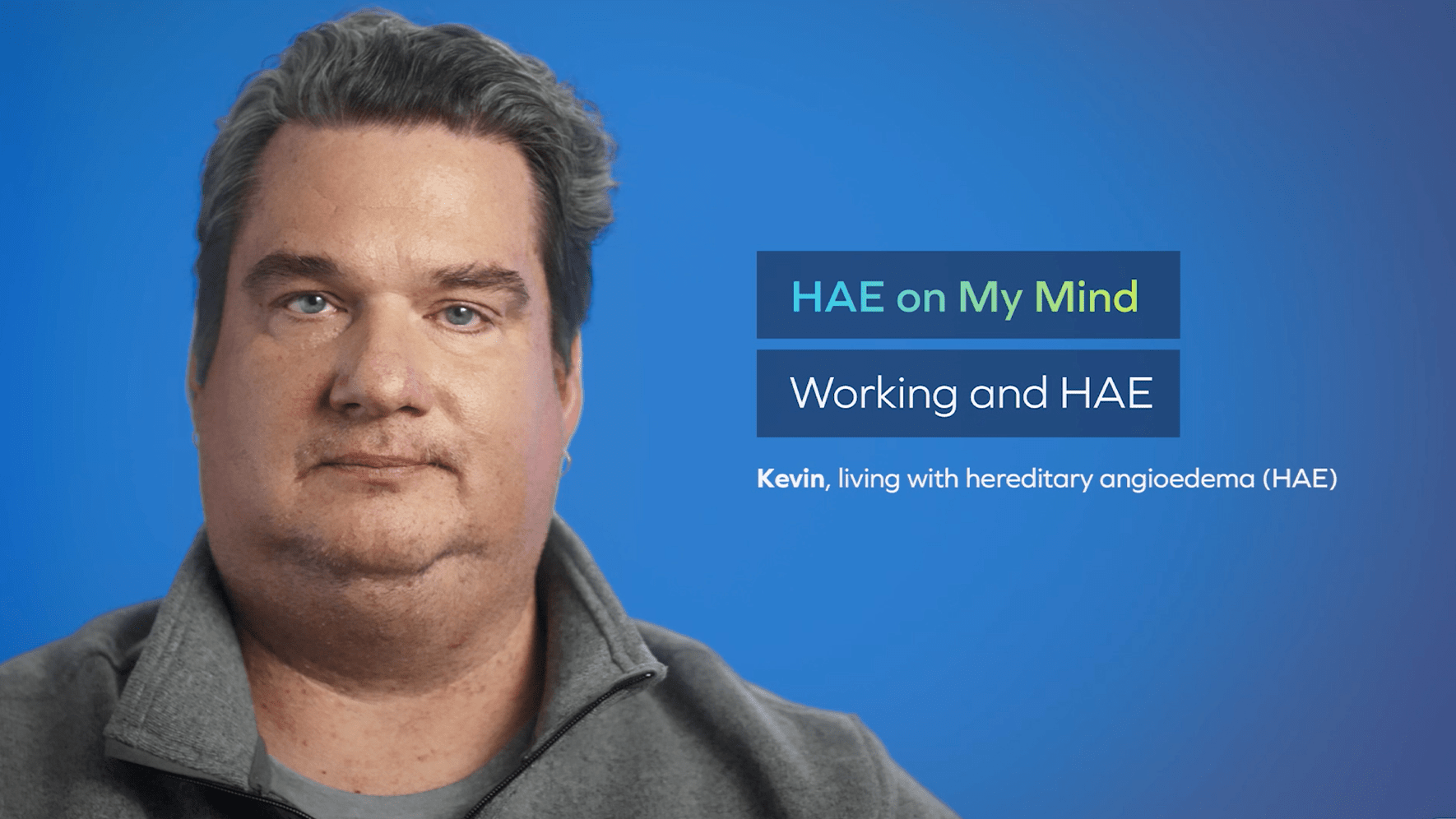 Kevin, patient living and working with HAE.